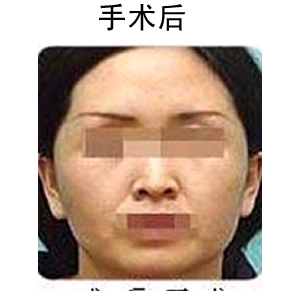 粨Ƥ۸