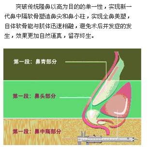 大鼻头怎么缩小好