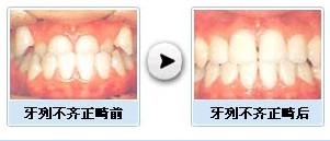 ݽЧǰԱͼ