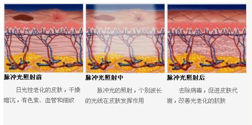 皮肤干燥脱皮怎么办_青岛华韩整形美容医院