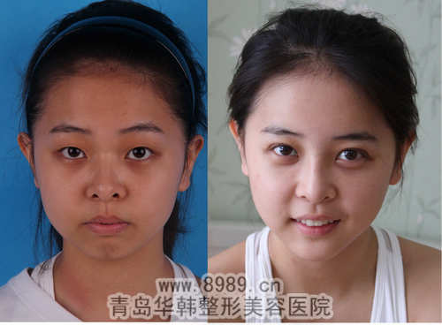 皮肤<em>发黄</em>如何改善_青岛华韩整形美容医院