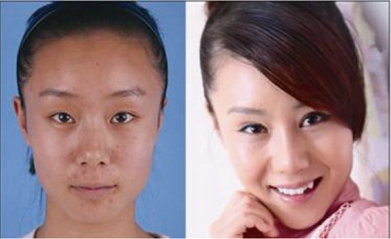 眼角长黄褐斑怎么办_青岛华韩整形美容医院